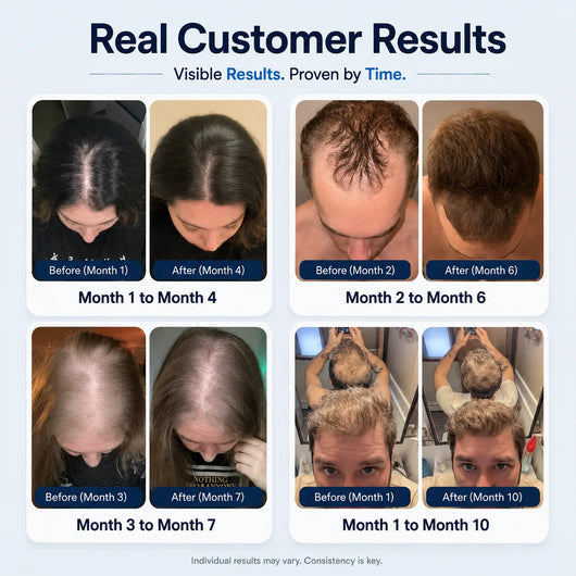 ReviveFoam™ - Hair Growth Formula