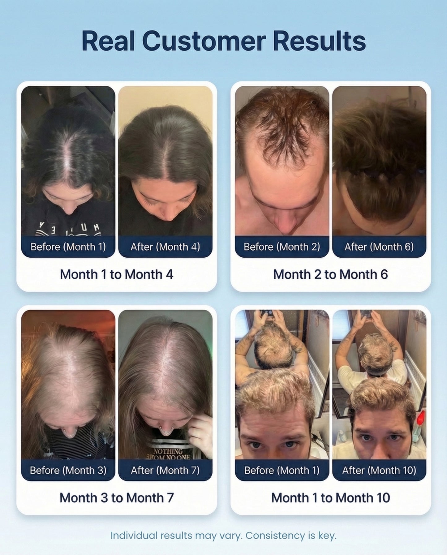 ReviveFoam™ - Hair Growth Formula