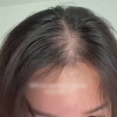 ReviveFoam™ - Hair Growth Formula